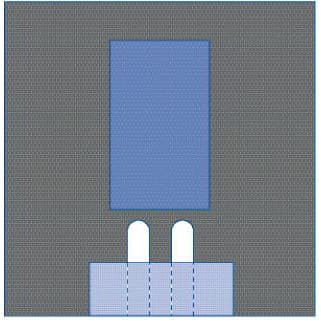 Medline Bilateral Split Drape - Case of 20 - Image 2