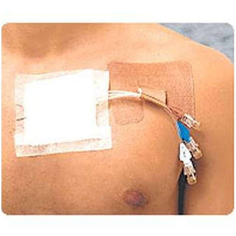 Cath-Strip Multi-Use Reclosable Catheter Fastener - Image 2