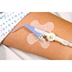 Cath-Secure Plus Tube Holder, 2-1/2 Inch, Butterfly Base