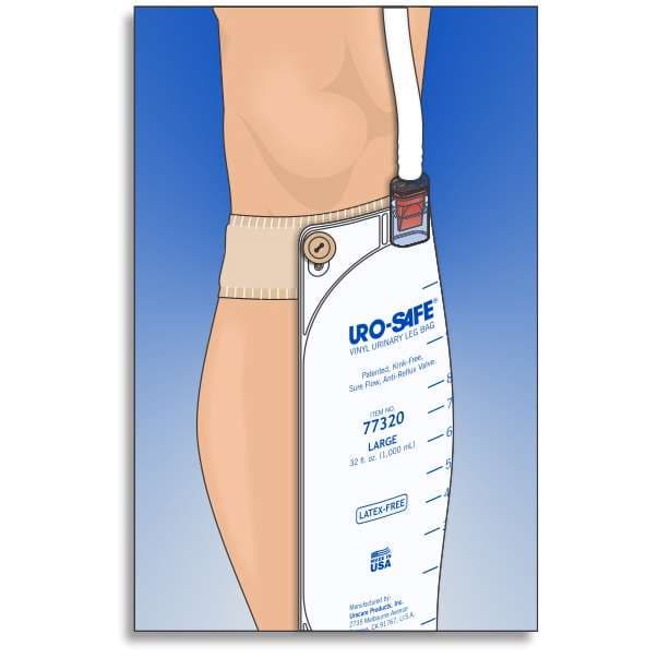 Urocare Fitz-All Fabric Leg Straps with Button - Image 3