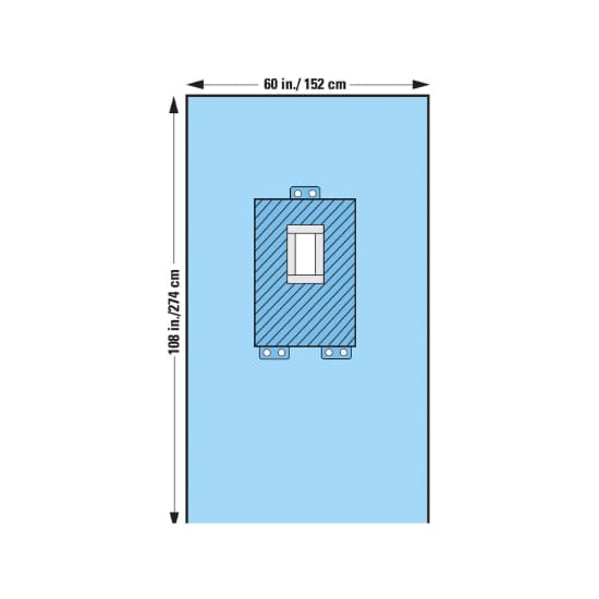 O and M Halyard Inc Abdominal Drape Blue 60 W x 108 L Inch Pediatric Laparotomy Drape - Case of 15 - Image 1