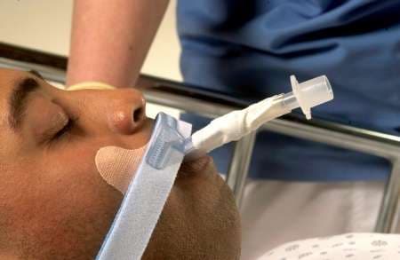 Dale Stabilock Endotracheal Tube Holder With Adhesive Tape