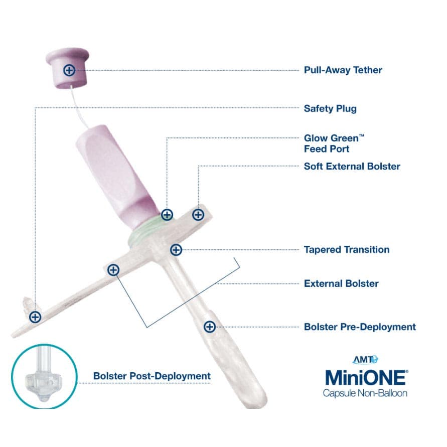AMT Mini ONE Capsule Enfit Non-Balloon Button Feeding Device - Image 2