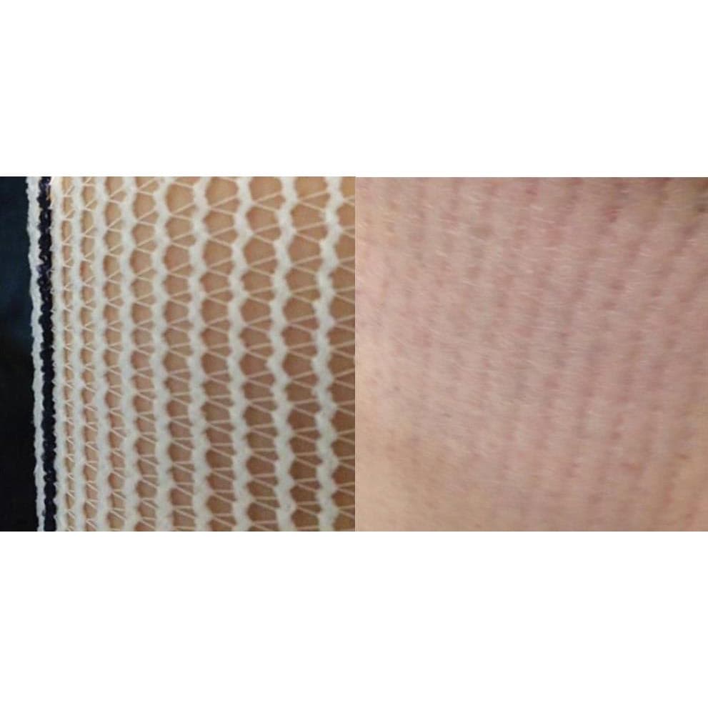 EdemaWear Compression Stockinette - Image 3