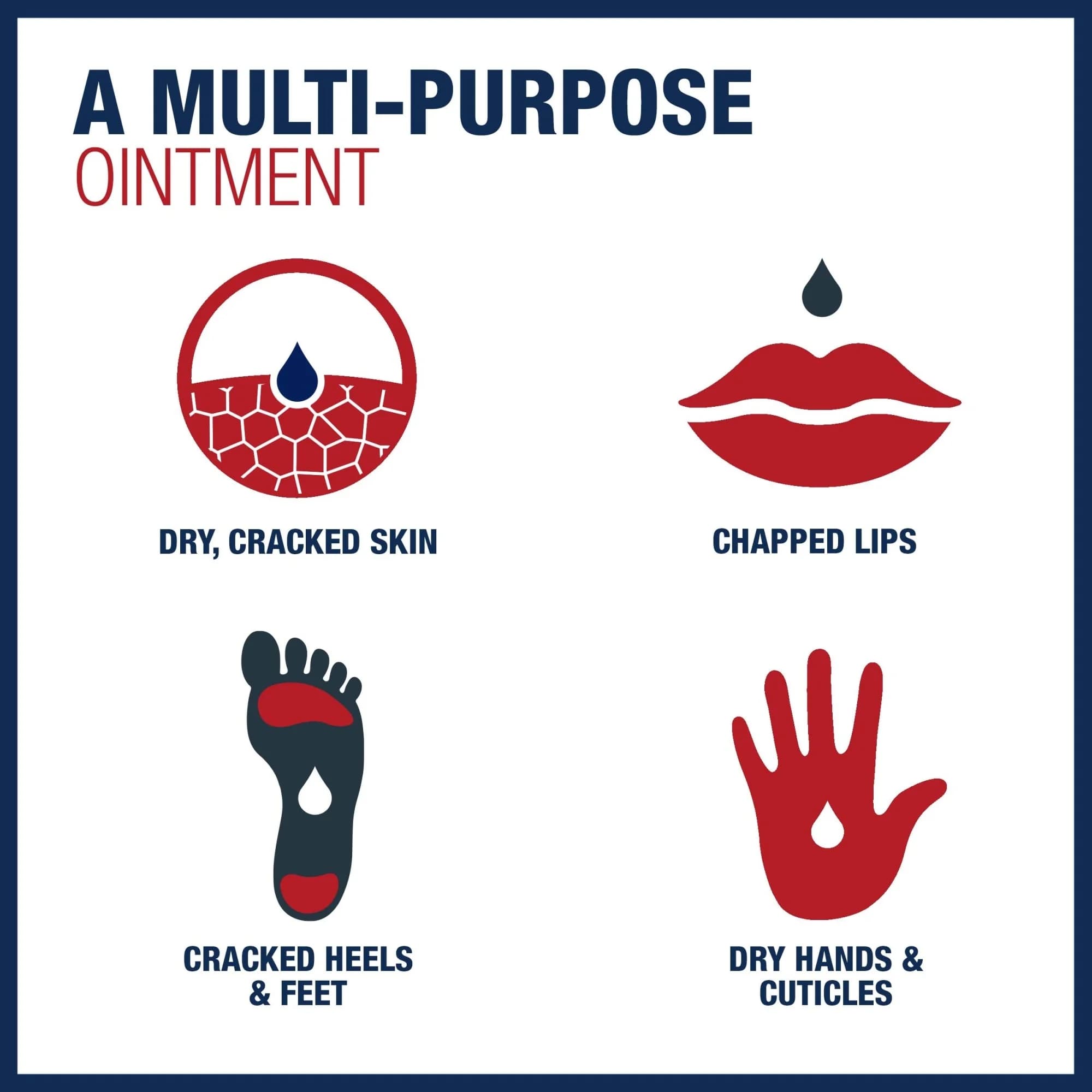 Aquaphor Advanced Therapy Healing Ointment - Image 5