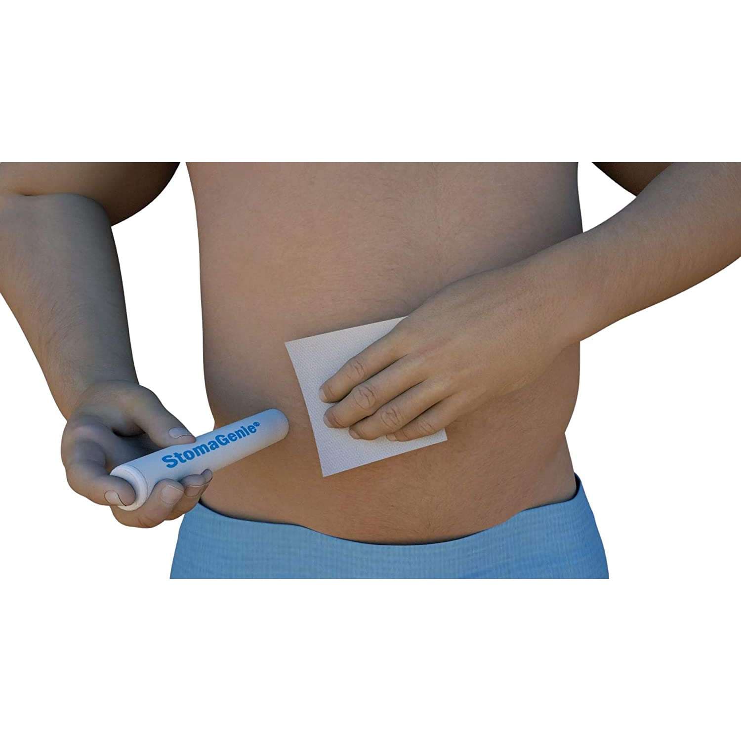 StomaGenie Capture Cartridge, 1-3/8" (34mm) Inside Diameter - Package of 10 - Image 1