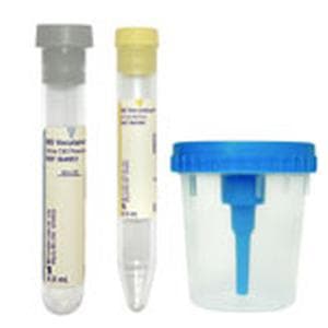 BD Vacutainer Urine Specimen Collection Kit