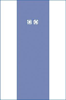 Medline Sterile Femoral Angiography Surgical Drape - Image 1