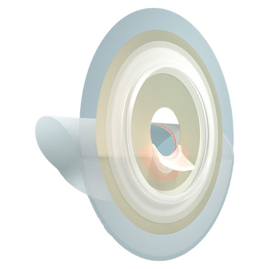 Ostoform FLOWASSIST 2-Piece Flat Baseplate, Cut-to-Fit, Extended Wear