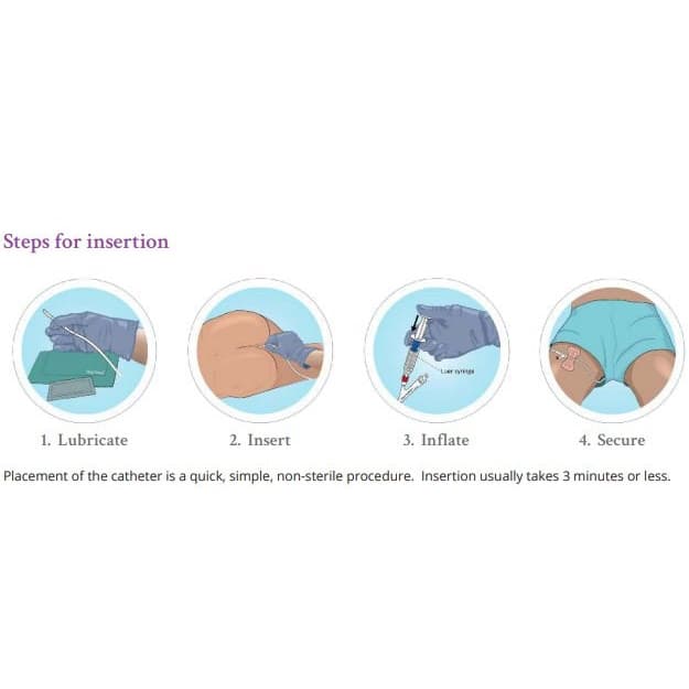 The Macy Catheter Rectal Medication Administration System, Bedside Care Kit - Image 2