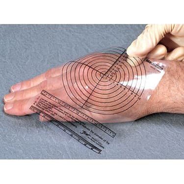 Wound Measuring Devices