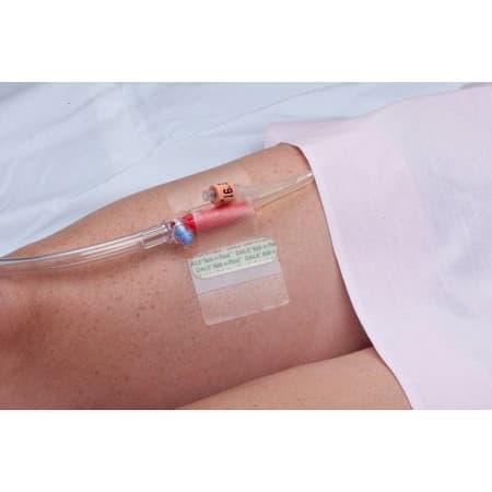 Dale Hold-n-Place Catheter Holder for Foley Catheter, One Size Fits All - Image 1