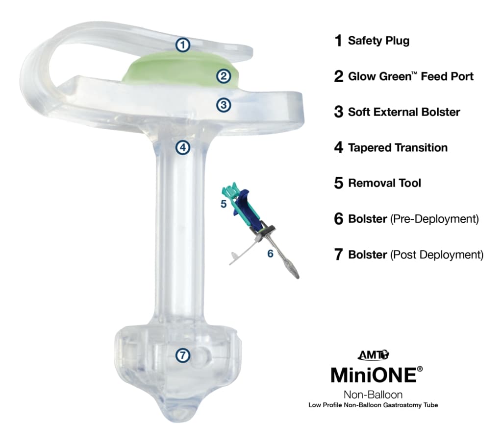 AMT Mini One Enfit Low Profile Non-Balloon Button Gastrostomy Tube Kit - Image 2
