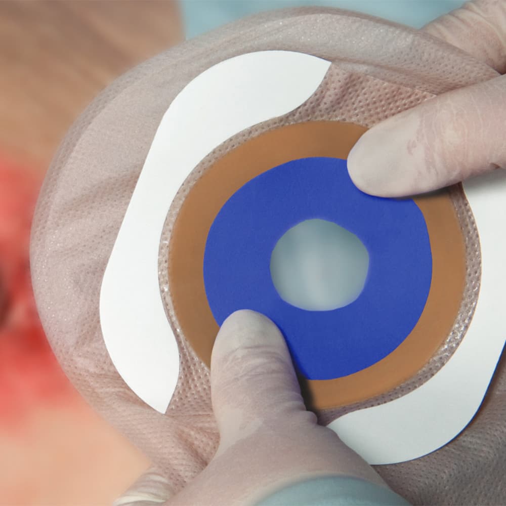 Hydrofera Blue Classic Antibacterial Foam Ostomy Dressing - Image 3