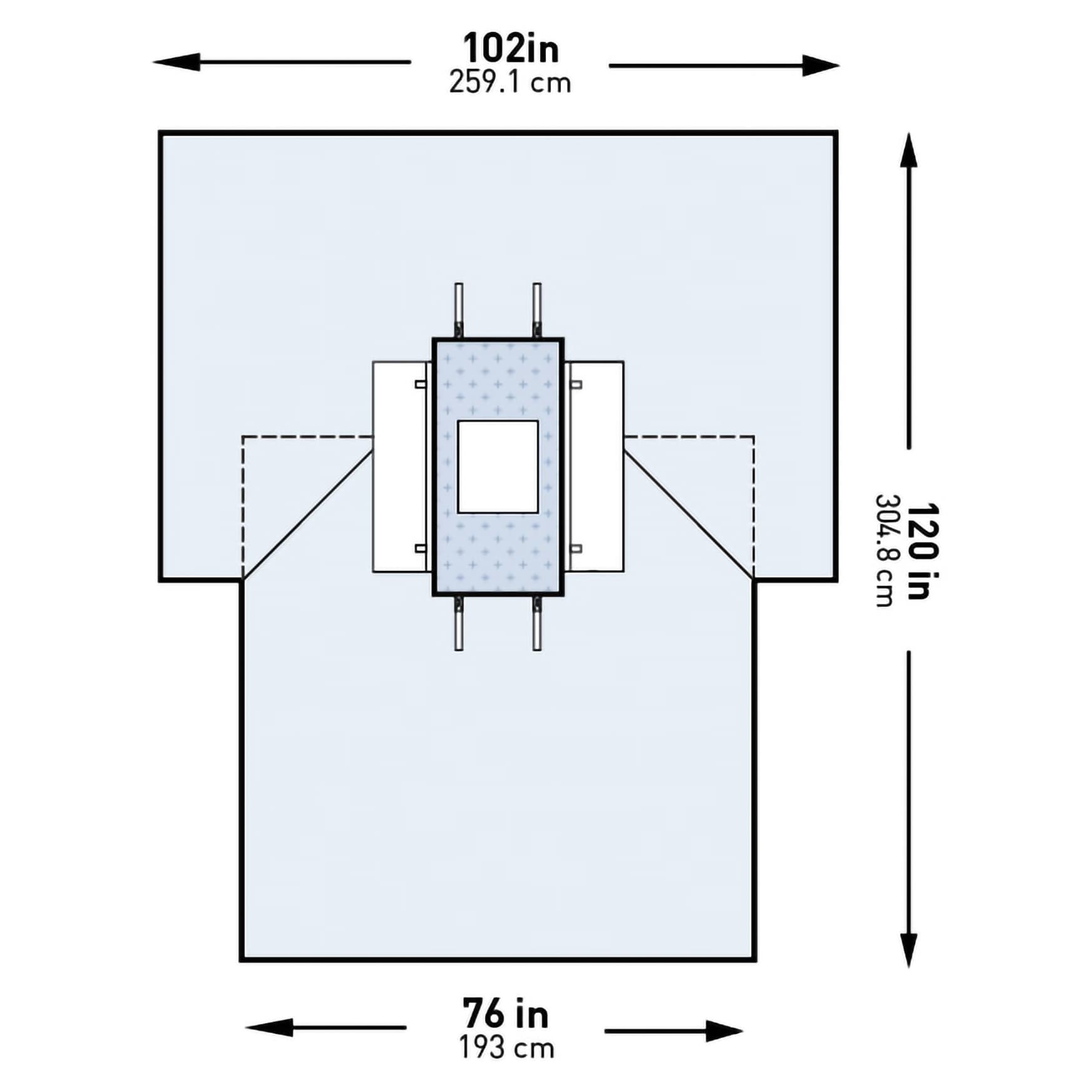 McKesson Abdominal Blue Laparotomy Drape - Image 1