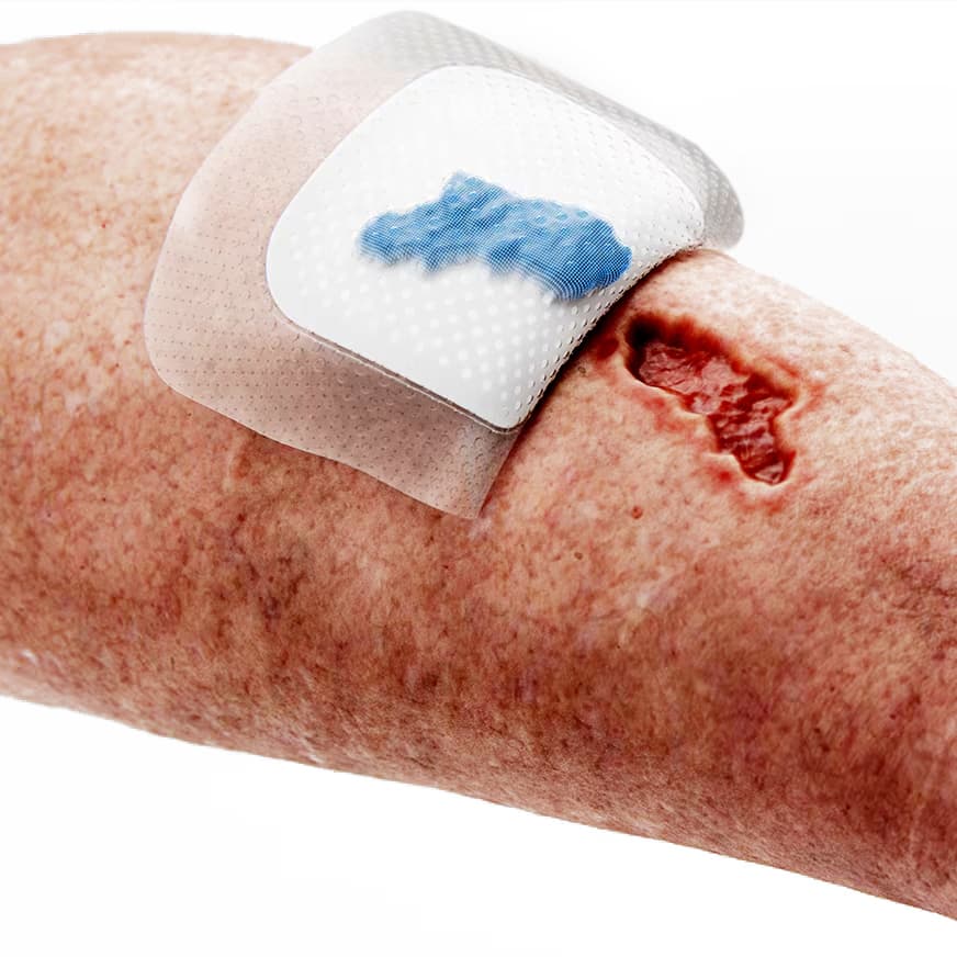 Coloplast Biatain Bordered Silicone Fit Foam Dressing - Image 4