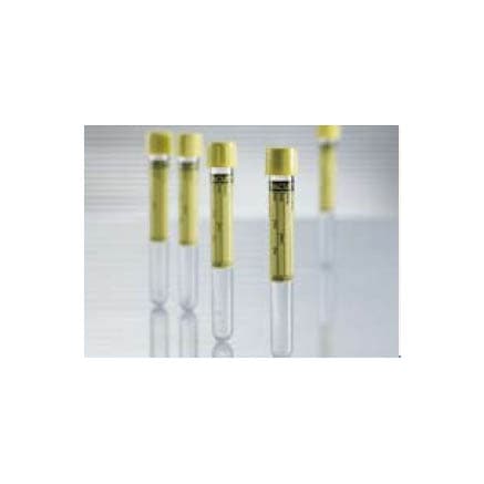 Vacuette Urinalysis Tube Plain Sterile Clear Tube - Image 1