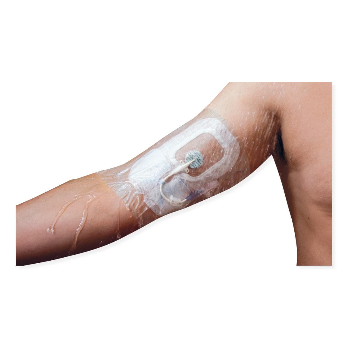 ShowerGuard Wound Protector