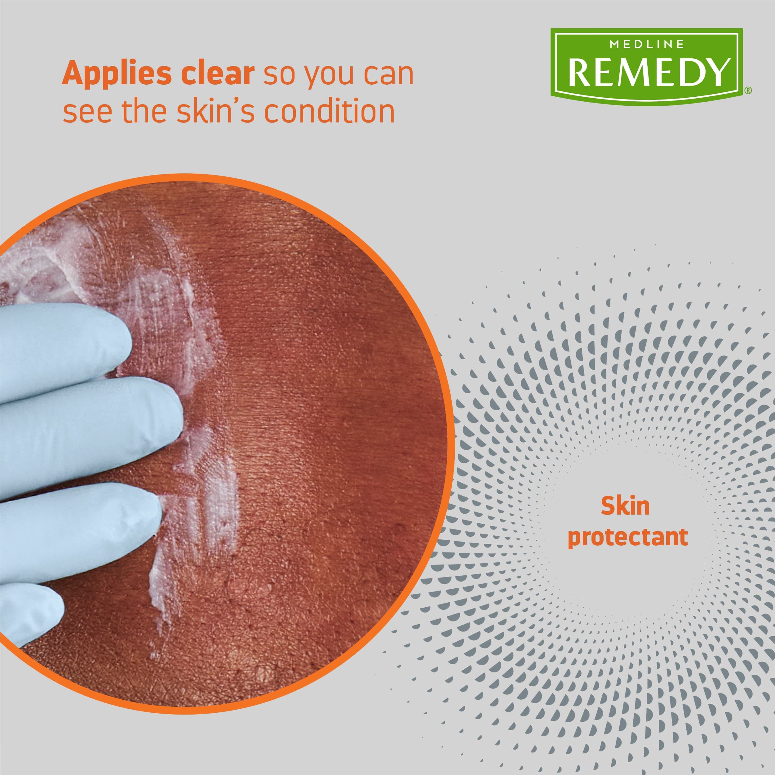 Remedy Specialized Protect Clear Zinc Ointment, 2.5 oz - Image 7