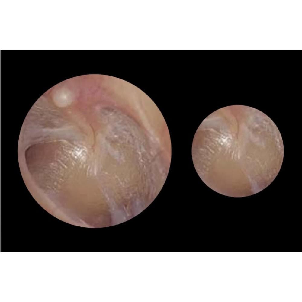 ADC Diagnostix 5422 3.5V PMV Otoscope Head - Image 2